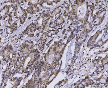 MLH1 Rabbit Polyclonal Antibody