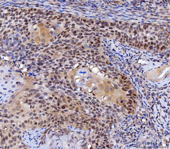 MLH1 Rabbit Polyclonal Antibody