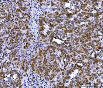MLH1 Rabbit Polyclonal Antibody