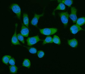 ME1 Rabbit Polyclonal Antibody