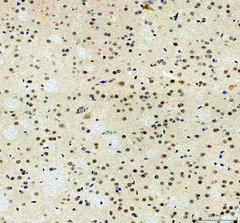 p38 alpha/MAPK14 Rabbit Polyclonal Antibody