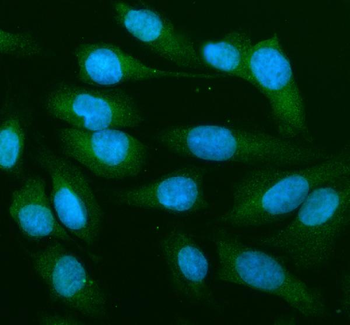 MEK1/MAP2K1 Rabbit Polyclonal Antibody