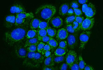 Glutaredoxin 1/GLRX Rabbit Polyclonal Antibody