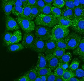 Ezrin/EZR Rabbit Polyclonal Antibody
