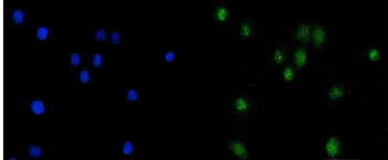 KAT3B/p300/EP300 Rabbit Polyclonal Antibody