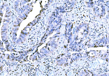 KAT3B/p300/EP300 Rabbit Polyclonal Antibody