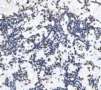KAT3B/p300/EP300 Rabbit Polyclonal Antibody