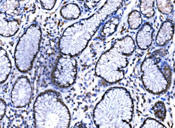 KAT3B/p300/EP300 Rabbit Polyclonal Antibody