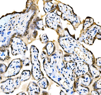KAT3B/p300/EP300 Rabbit Polyclonal Antibody