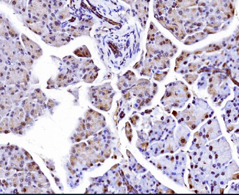 Elongin-C/ELOC Rabbit Polyclonal Antibody