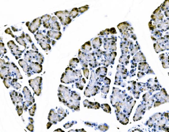 Elongin-C/ELOC Rabbit Polyclonal Antibody