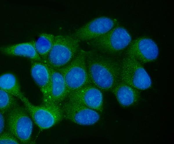 TCEB2/Elongin-B/ELOB Rabbit Polyclonal Antibody
