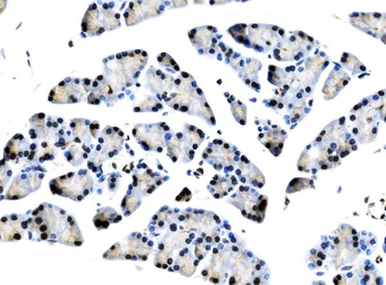 TCEB2/Elongin-B/ELOB Rabbit Polyclonal Antibody