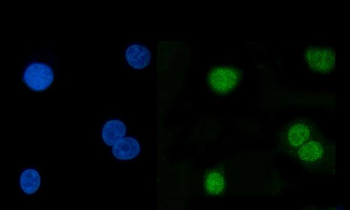 Hsp40/DNAJB1 Rabbit Polyclonal Antibody