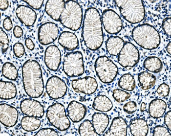 Hsp40/DNAJB1 Rabbit Polyclonal Antibody
