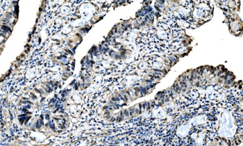 DLX2 Rabbit Polyclonal Antibody
