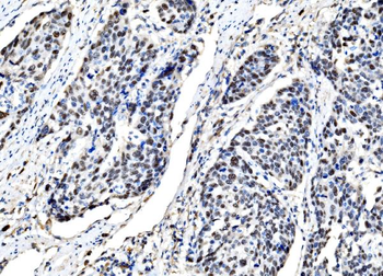 DLX2 Rabbit Polyclonal Antibody