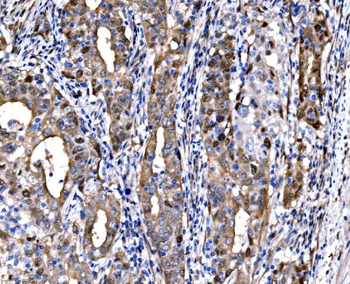 DLX2 Rabbit Polyclonal Antibody