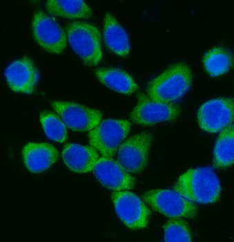 DDX3/DDX3X Rabbit Polyclonal Antibody