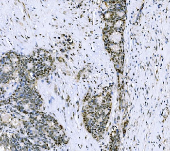 CSNK2B Rabbit Polyclonal Antibody