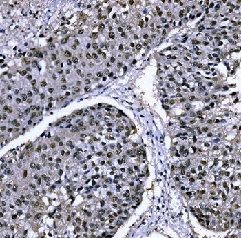CSNK2B Rabbit Polyclonal Antibody