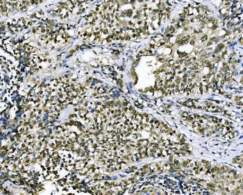 CSNK2B Rabbit Polyclonal Antibody