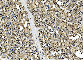 CSNK2B Rabbit Polyclonal Antibody