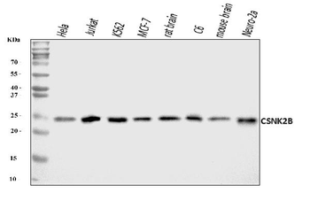 CSNK2B Rabbit Polyclonal Antibody