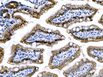 CSNK2A2 Rabbit Polyclonal Antibody