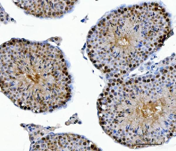 CSNK2A2 Rabbit Polyclonal Antibody