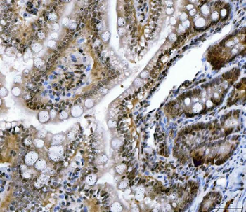 CSNK2A2 Rabbit Polyclonal Antibody