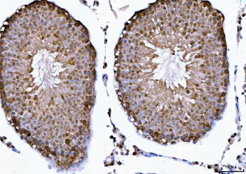 CSNK2A2 Rabbit Polyclonal Antibody