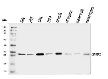 CSNK2A2 Rabbit Polyclonal Antibody