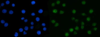 CSNK2A2 Rabbit Polyclonal Antibody