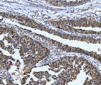 CSNK2A2 Rabbit Polyclonal Antibody
