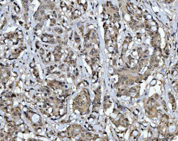 CSNK2A2 Rabbit Polyclonal Antibody