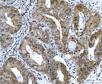 CSNK2A2 Rabbit Polyclonal Antibody