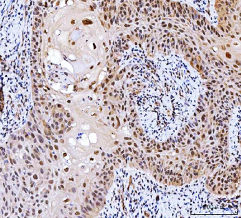 CSNK2A2 Rabbit Polyclonal Antibody