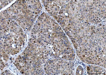 CSNK2A2 Rabbit Polyclonal Antibody
