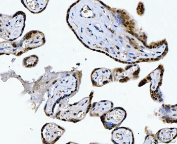 CSNK2A2 Rabbit Polyclonal Antibody