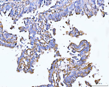 Collagen VI/COL6A2 Rabbit Polyclonal Antibody