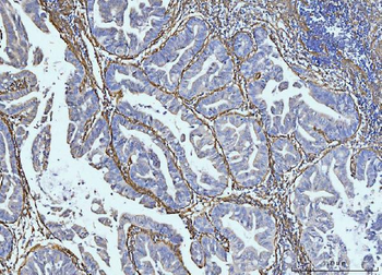 Collagen VI/COL6A2 Rabbit Polyclonal Antibody