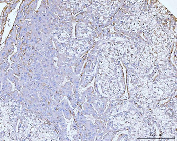 Collagen VI/COL6A2 Rabbit Polyclonal Antibody
