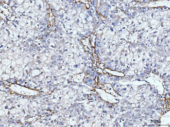Collagen VI/COL6A2 Rabbit Polyclonal Antibody