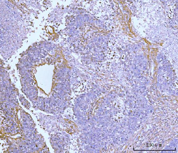 Collagen VI/COL6A2 Rabbit Polyclonal Antibody