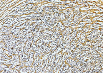 Collagen VI/COL6A2 Rabbit Polyclonal Antibody