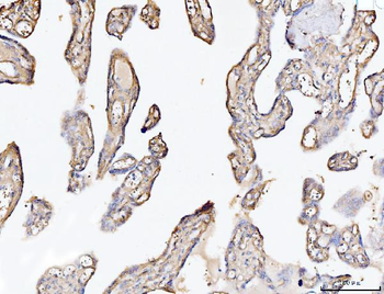 Collagen VI/COL6A2 Rabbit Polyclonal Antibody