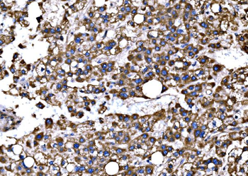 Bim/BCL2L11 Rabbit Polyclonal Antibody