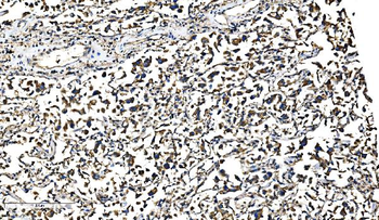 Bim/BCL2L11 Rabbit Polyclonal Antibody