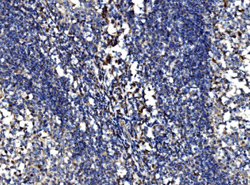 Bim/BCL2L11 Rabbit Polyclonal Antibody
